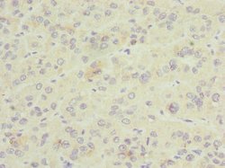Invitrogen GDAP1 Polyclonal Antibody 100 &mu;L; Unconjugated:Antibodies,