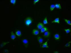 Invitrogen GDF5 Polyclonal Antibody 100 &mu;L; Unconjugated:Antibodies,