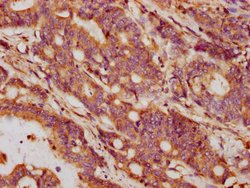 Invitrogen GDF5 Polyclonal Antibody 100 &mu;L; Unconjugated:Antibodies,