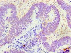 Invitrogen GDF5 Polyclonal Antibody 100 &mu;L; Unconjugated:Antibodies,