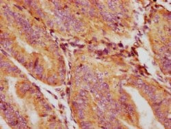 Invitrogen GDF5 Polyclonal Antibody 100 &mu;L; Unconjugated:Antibodies,