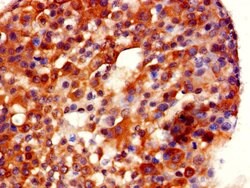 Invitrogen GDI2 Polyclonal Antibody 100 &mu;g; Unconjugated:Antibodies,