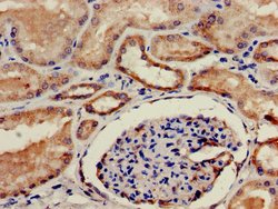 Invitrogen TSTA3 Polyclonal Antibody 100 &mu;g; Unconjugated:Antibodies,