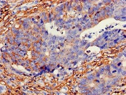 Invitrogen GH2 Polyclonal Antibody 100 &mu;g; Unconjugated:Antibodies,