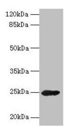 Invitrogen GH2 Polyclonal Antibody 100 &mu;g; Unconjugated:Antibodies,