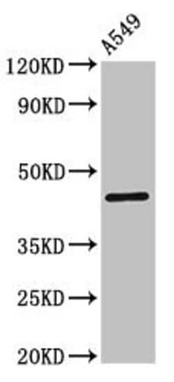 Invitrogen Connexin 45 Polyclonal Antibody 100 &mu;g | Buy Online | Invitrogen&trade; | Fisher Scientific