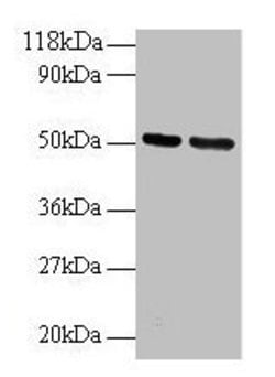 Invitrogen GDI2 Polyclonal Antibody 100 &mu;g; Unconjugated:Antibodies,