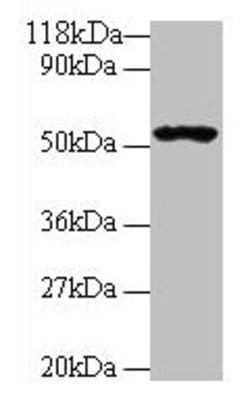 Invitrogen GLP1R Polyclonal Antibody 100 &mu;g; Unconjugated:Antibodies,