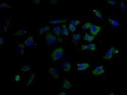 Invitrogen GLP1R Polyclonal Antibody 100 &mu;g; Unconjugated:Antibodies,