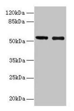Invitrogen GLP1R Polyclonal Antibody 100 &mu;g; Unconjugated:Antibodies,