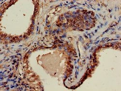 Invitrogen GNA14 Polyclonal Antibody 100 &mu;g; Unconjugated:Antibodies,