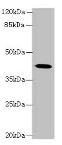 Invitrogen GNA14 Polyclonal Antibody 100 &mu;g; Unconjugated:Antibodies,