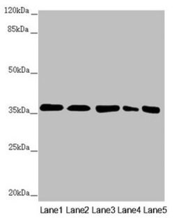 Invitrogen GNB2 Polyclonal Antibody 100 &mu;L; Unconjugated:Antibodies,