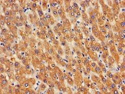 Invitrogen GOSR2 Polyclonal Antibody 100 &mu;g; Unconjugated:Antibodies,