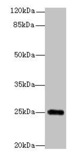 Invitrogen GOSR2 Polyclonal Antibody 100 &mu;g; Unconjugated:Antibodies,
