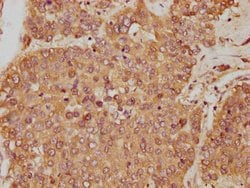 Invitrogen GOT1 Polyclonal Antibody 100 &mu;g; Unconjugated:Antibodies,