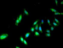 Invitrogen PP2A beta Polyclonal Antibody 100 &mu;g; Unconjugated:Antibodies,