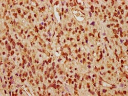 Invitrogen PP2A beta Polyclonal Antibody 100 &mu;g; Unconjugated:Antibodies,