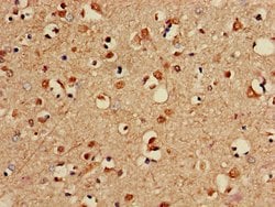 Invitrogen PP2A beta Polyclonal Antibody 100 &mu;g; Unconjugated:Antibodies,