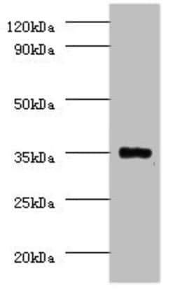 Invitrogen PP2A beta Polyclonal Antibody 100 &mu;g; Unconjugated:Antibodies,