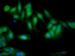 Invitrogen Gelsolin Polyclonal Antibody 100 &mu;g; Unconjugated:Antibodies,