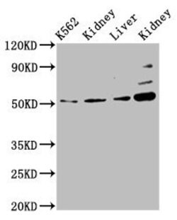 Invitrogen GSS Polyclonal Antibody 100 &mu;g | Buy Online | Invitrogen&trade; | Fisher Scientific