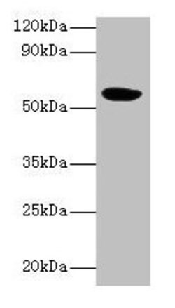 Invitrogen HARS2 Polyclonal Antibody 100 &mu;g; Unconjugated:Antibodies,