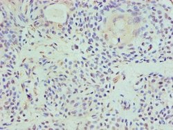 Invitrogen HAT1 Polyclonal Antibody 100 &mu;L; Unconjugated:Antibodies,