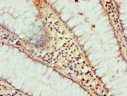 Invitrogen HAT1 Polyclonal Antibody 100 &mu;L; Unconjugated:Antibodies,