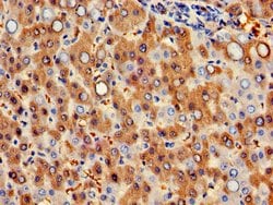 Invitrogen HBB Polyclonal Antibody 100 &mu;g; Unconjugated:Antibodies,