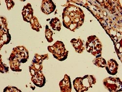 Invitrogen HBB Polyclonal Antibody 100 &mu;g; Unconjugated:Antibodies,