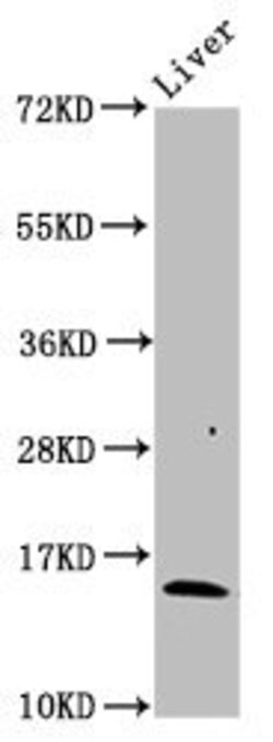Invitrogen HBB Polyclonal Antibody 100 &mu;g; Unconjugated:Antibodies,