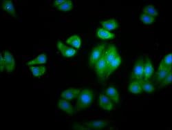 Invitrogen HBG2 Polyclonal Antibody 100 &mu;g; Unconjugated:Antibodies,
