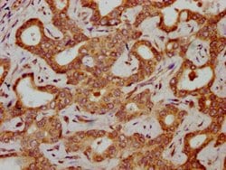 Invitrogen HBG2 Polyclonal Antibody 100 &mu;g; Unconjugated:Antibodies,