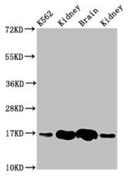 Invitrogen HBG2 Polyclonal Antibody 100 &mu;g; Unconjugated:Antibodies,