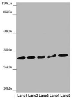 HCCS Polyclonal Antibody:Antibodies, Polyclonal