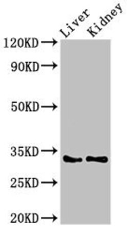 HEXIM2 Polyclonal Antibody 100 &mu;g | Buy Online | Invitrogen | Fisher Scientific
