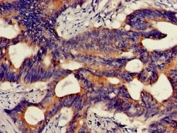 Invitrogen HMBS Polyclonal Antibody 100 &mu;g; Unconjugated:Antibodies,