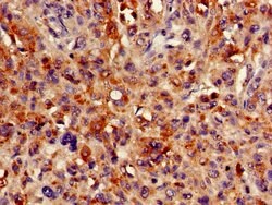 Invitrogen HMBS Polyclonal Antibody 100 &mu;g; Unconjugated:Antibodies,