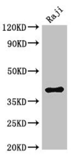 Invitrogen HMBS Polyclonal Antibody 100 &mu;g; Unconjugated:Antibodies,