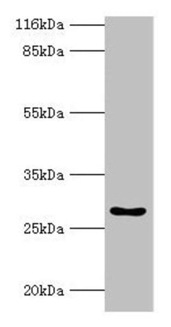 Invitrogen HOXA6 Polyclonal Antibody 100 &mu;g; Unconjugated:Antibodies,