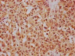 Invitrogen HRG Polyclonal Antibody 100 &mu;g; Unconjugated:Antibodies,