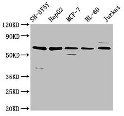 Invitrogen HRG Polyclonal Antibody 100 &mu;g; Unconjugated:Antibodies,