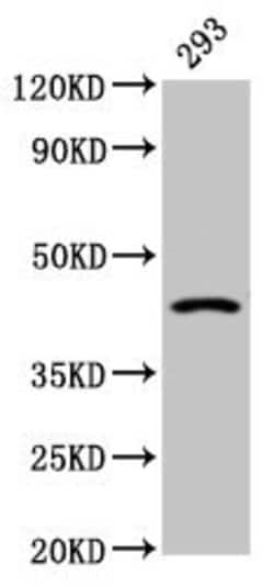 Invitrogen HSD11B2 Polyclonal Antibody 100 &mu;g; Unconjugated:Antibodies,