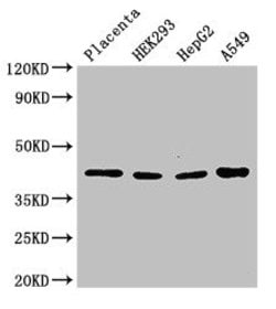 Invitrogen HSD3B1 Polyclonal Antibody 100 &mu;g; Unconjugated:Antibodies,