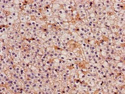 Invitrogen IDH3A Polyclonal Antibody 100 &mu;g; Unconjugated:Antibodies,