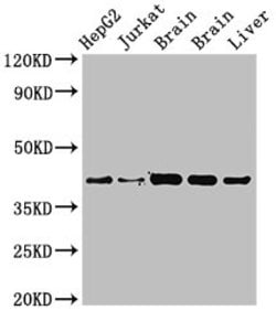 Invitrogen IDH3A Polyclonal Antibody 100 &mu;g; Unconjugated:Antibodies,