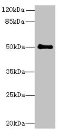 Invitrogen IFI44 Polyclonal Antibody 100 &mu;g; Unconjugated:Antibodies,