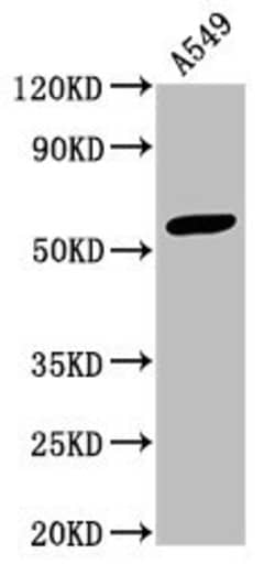 Invitrogen IFIT3 Polyclonal Antibody 100 &mu;g; Unconjugated:Antibodies,