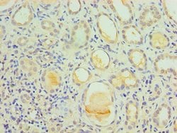Invitrogen IL1R1 Polyclonal Antibody 100 &mu;L | Buy Online | Invitrogen&trade; | Fisher Scientific